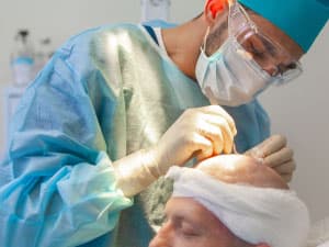 Latham Hair Restoration 3